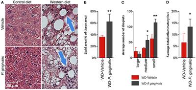 Diet-Induced Non-alcoholic Fatty Liver Disease and Associated Gut Dysbiosis Are Exacerbated by Oral Infection